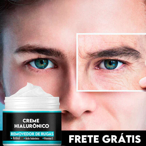 Creme Anti-idade Renew Skin - [ÚLTIMAS UNIDADES]